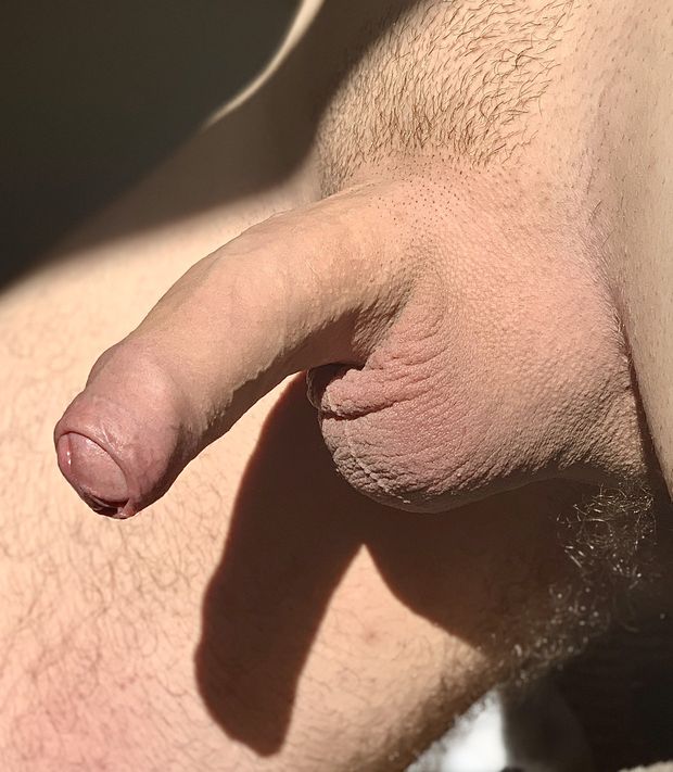 Shadow