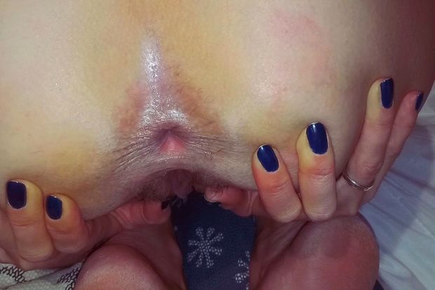 Wife spreading her butt
