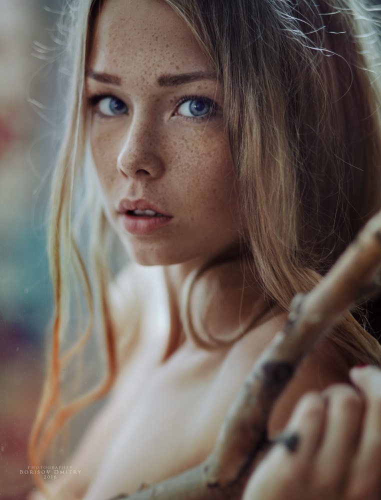 freckles