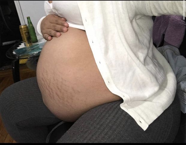 My Sexy Thicc Fat Pregnant Guatemalan Wife has sexist Stretch mark Skin in the World