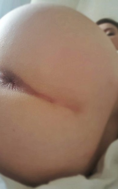 OpenAss