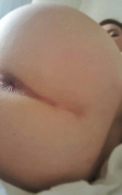 OpenAss