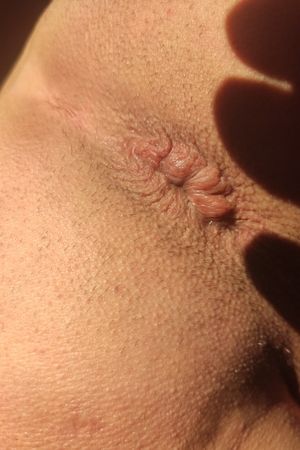 My anus needs torture