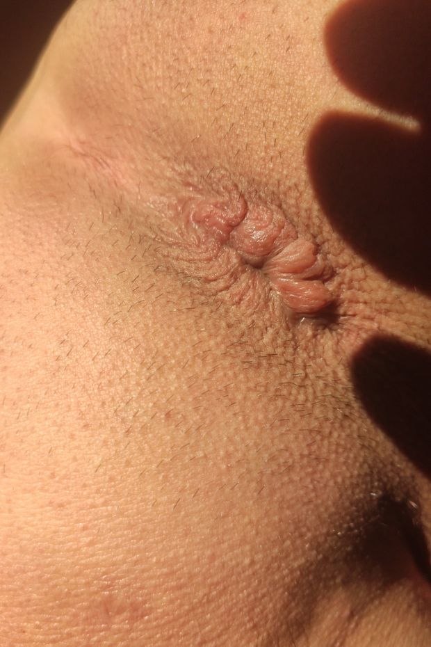My anus needs torture