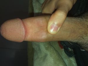 do you like it?this if my clity (18cm)