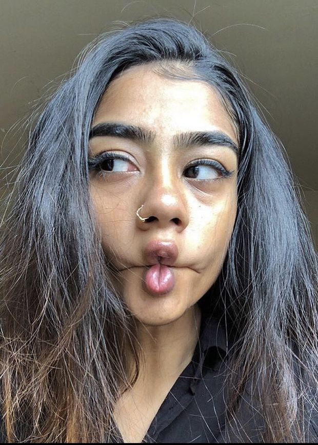 lips