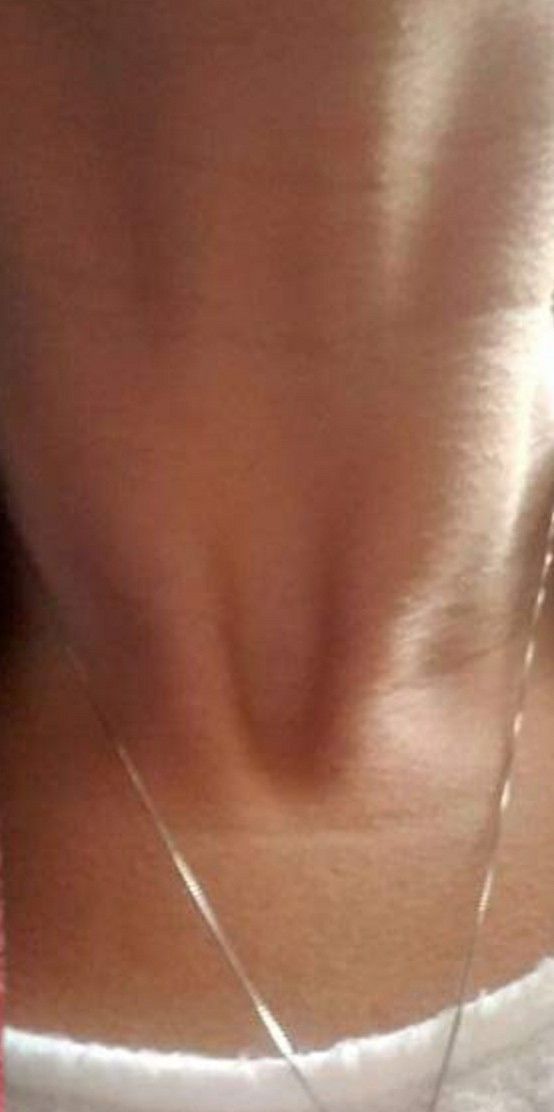 My throat