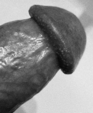 The perfect head of the penis