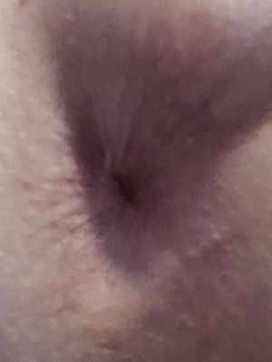 My jew butt hole