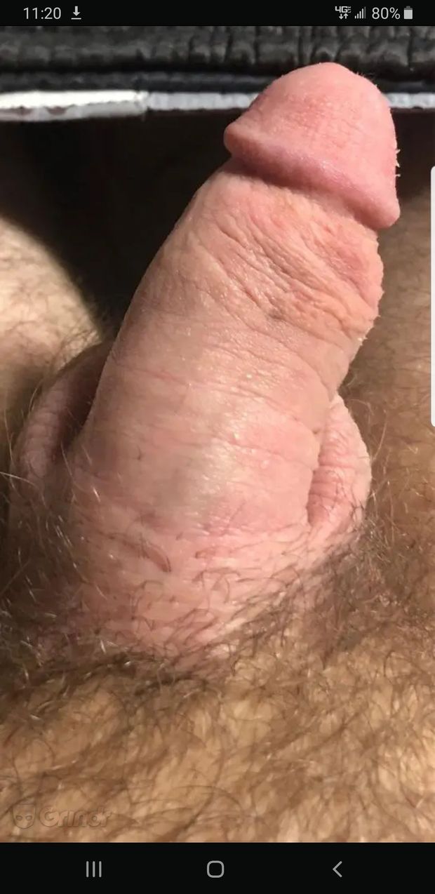 Dick