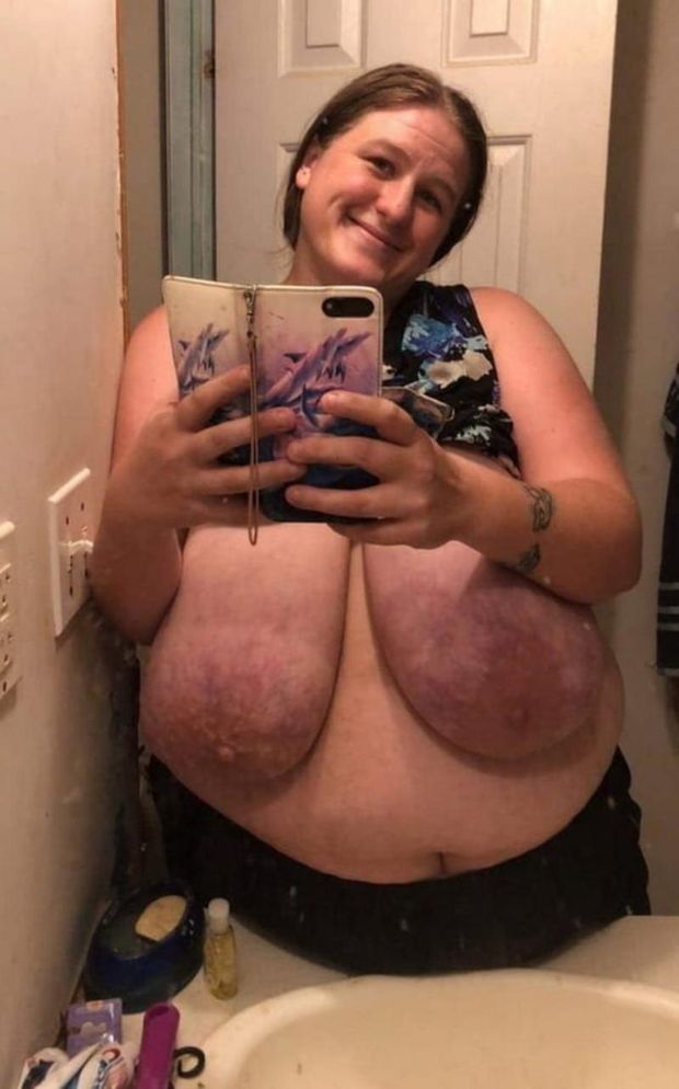 Mature fatty bares her massive saggy tits for naked selfie