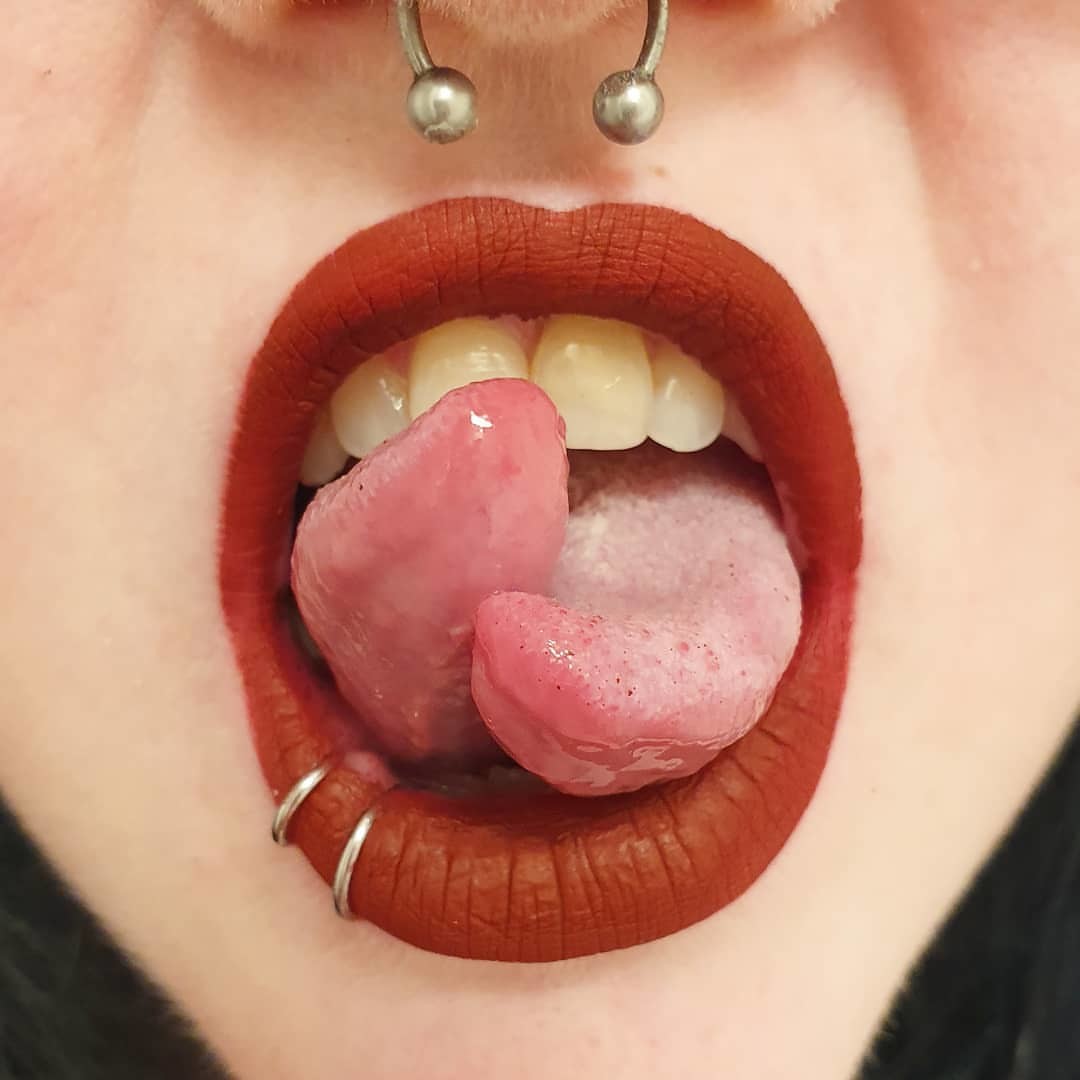 split tongue