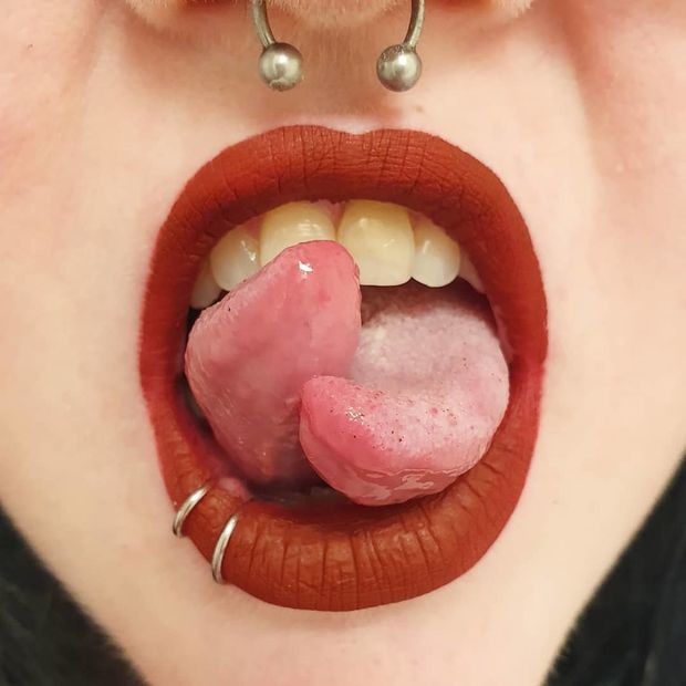split tongue