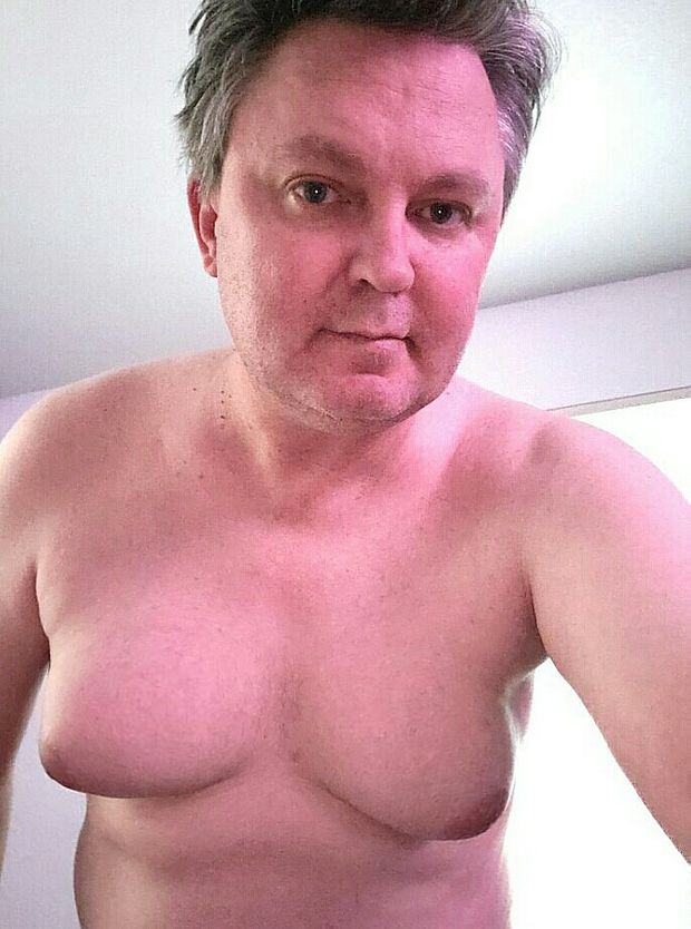 Sagging moobs