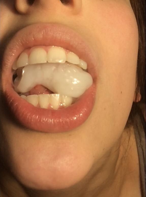 Snack