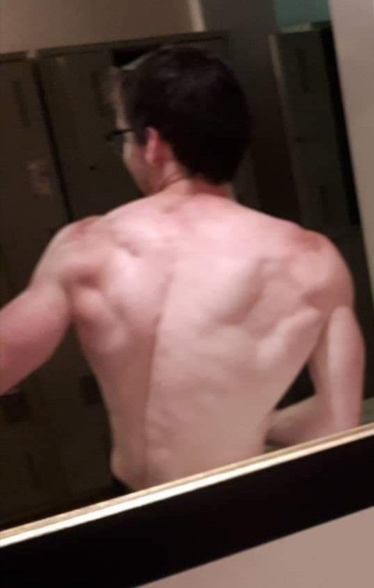 My back