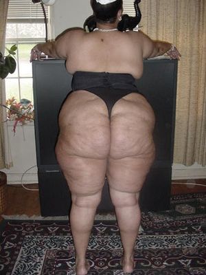Nice cellulite