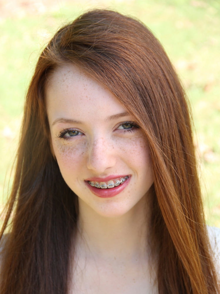 Redhead