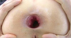 Little ass, big perfect gape