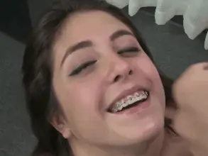 Braces babe