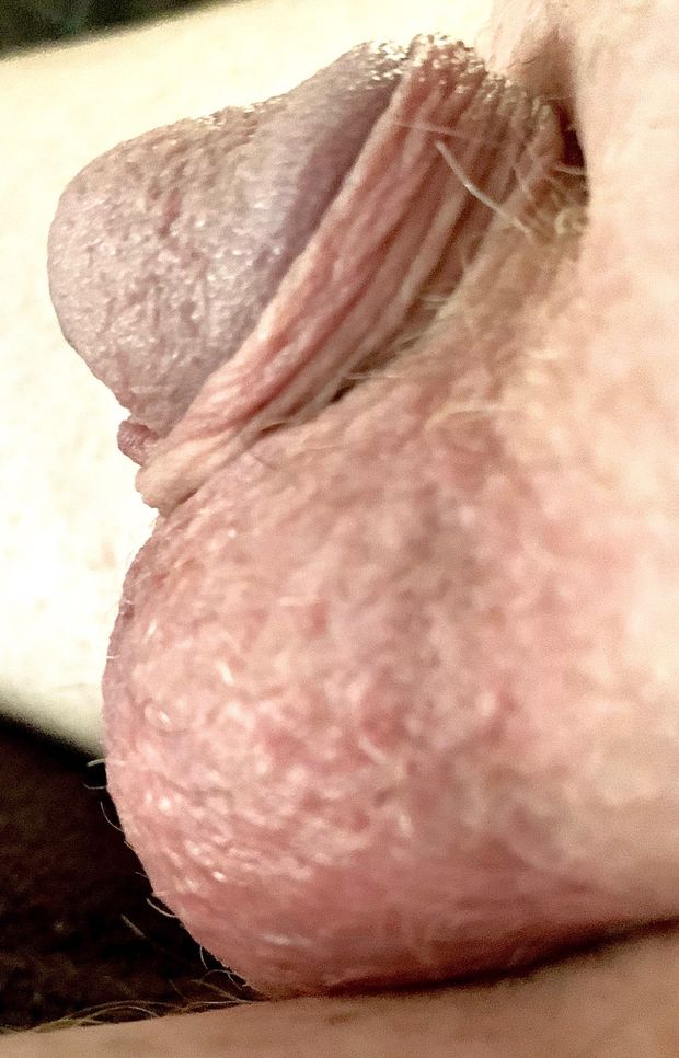 nipple prick