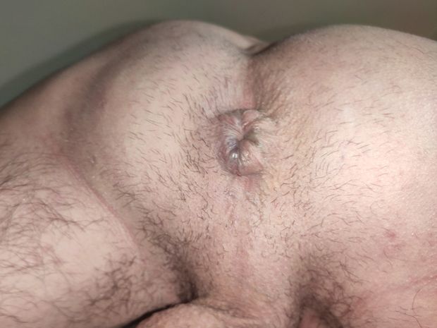 Hungry ass hole