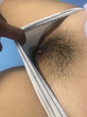 hairy peek 5