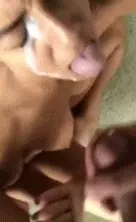 Teen gets a huge facial