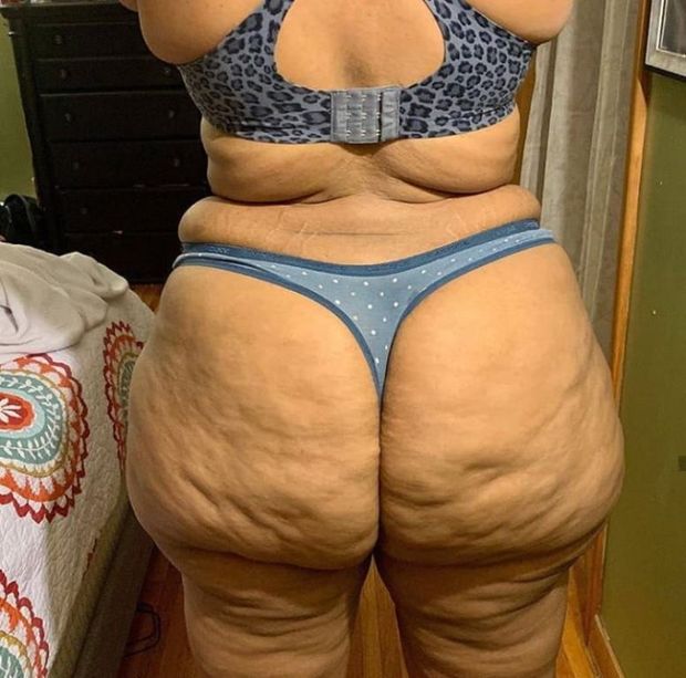 Cellulite Culos Are Beautiful , Yummy