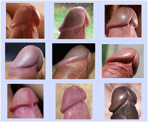 Penis Head Shapes