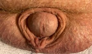 burrowing cock head