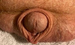 clitoris-penis