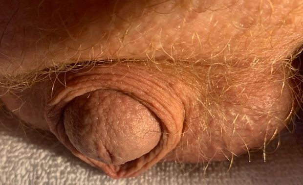 nipple dick