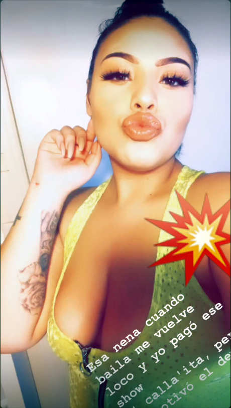 pucker up