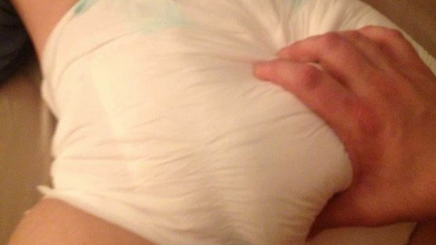 Diaper squeeze.