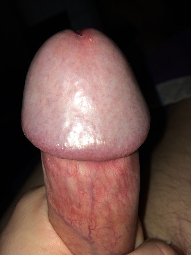 Swollen head
