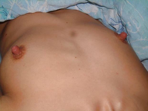 flat chest