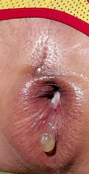 Gaping fuck hole closeup 1