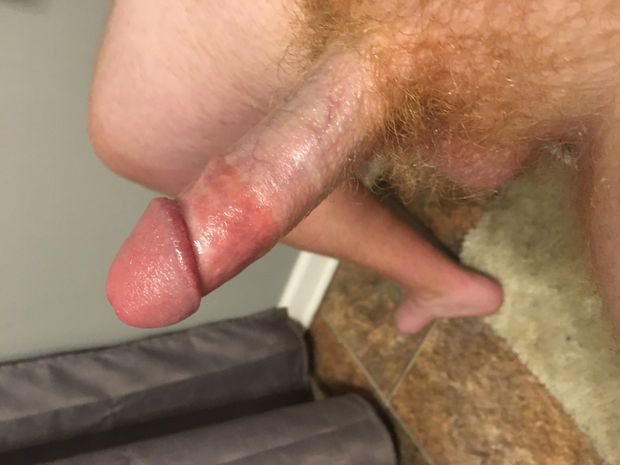 Rock solid