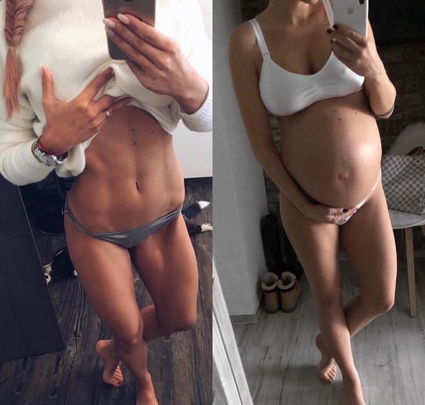 before and after