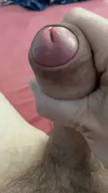 Foreskin
