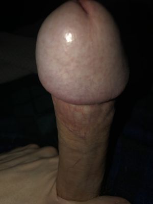 My head, swollen and shiny. It needs some huge titties to fuck.
