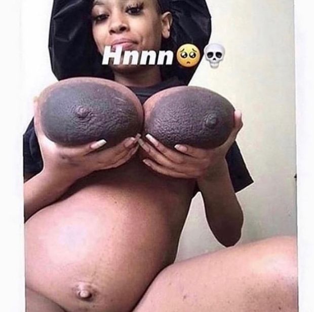Massive nipples
