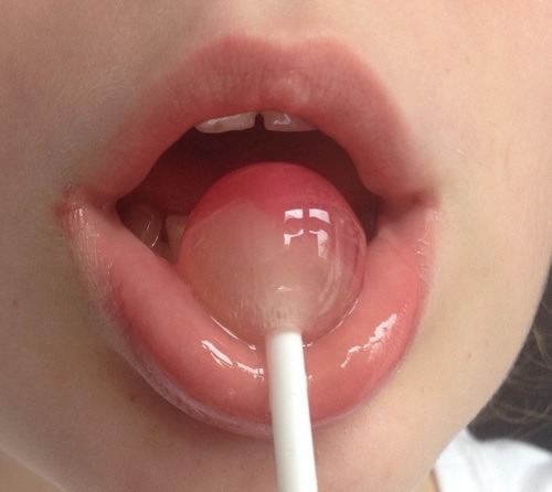 lollipop