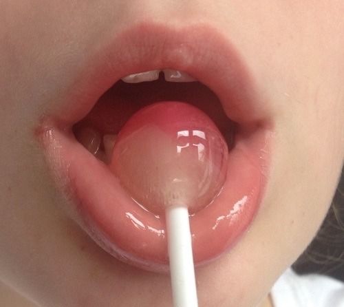 lollipop