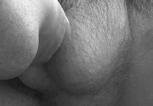 Tongue for hairy balls