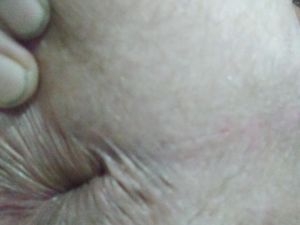 When i look at my asshole i get hungry. Can i eat your asshole?