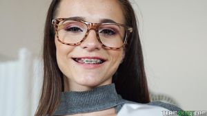 Toothless and Braces Smile