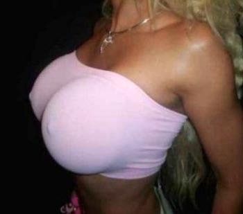 OMG