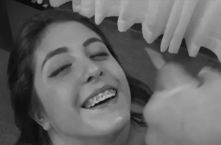 College braces and cum